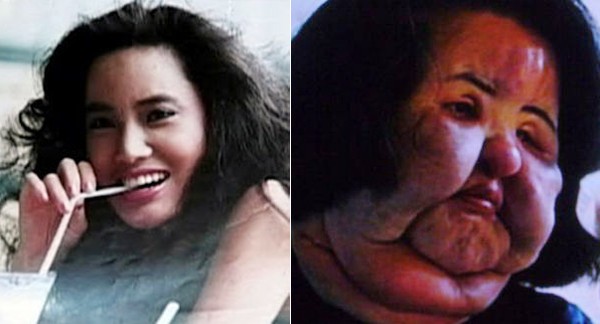 Kinh hoang nhung tham hoa sau tham my cua cac ngoi sao