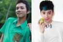 Anh chàng xấu trai hóa hotboy sau 10 lần phẫu thuật thẩm mỹ