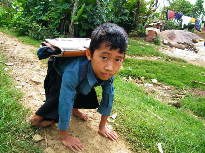 Kham phuc nhung hoc tro khuyet tat bo let den truong