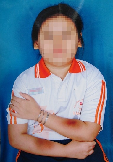 Giao vien danh hoc sinh bam tim hai tay
