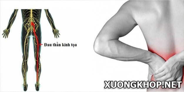 Kham pha 12 cung hoang dao bi di ung dieu gi?